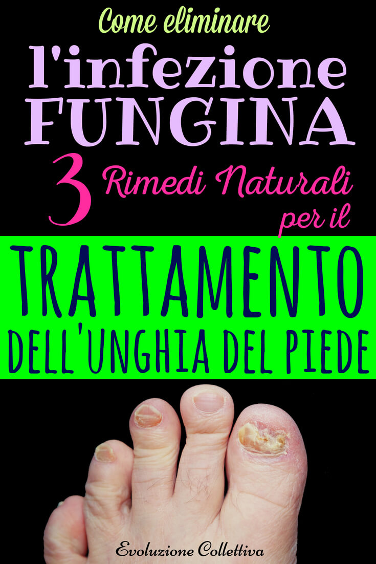 rimedi contro funghi pelle